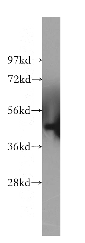 A375 cells were subjected to SDS PAGE followed by western blot with Catalog No:112376(MAGEA1 antibody) at dilution of 1:500