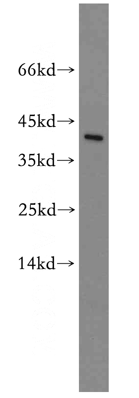 mouse brain tissue were subjected to SDS PAGE followed by western blot with Catalog No:116253(TOR2A antibody) at dilution of 1:100