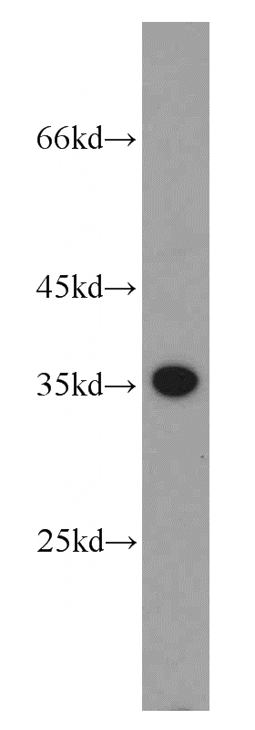 Jurkat cells were subjected to SDS PAGE followed by western blot with Catalog No:114237(PRPS1 antibody) at dilution of 1:400