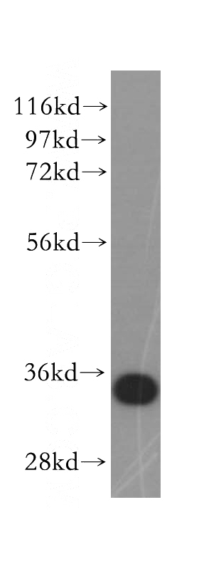 HeLa cells were subjected to SDS PAGE followed by western blot with Catalog No:110165(MAPRE1 antibody) at dilution of 1:500
