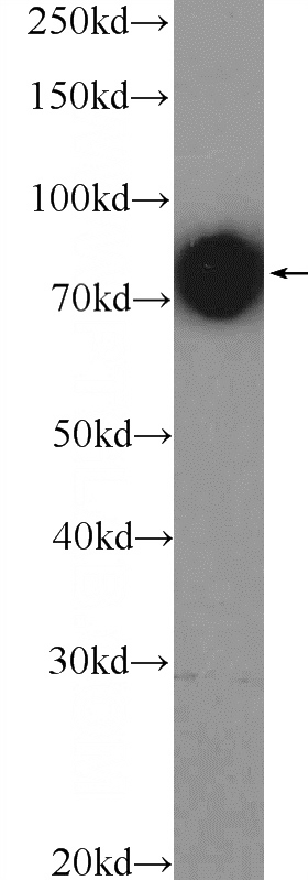 HeLa cells were subjected to SDS PAGE followed by western blot with Catalog No:110426(Ezrin Antibody) at dilution of 1:5000