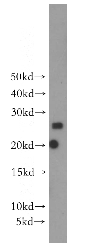human brain tissue were subjected to SDS PAGE followed by western blot with Catalog No:115006(SCN2B antibody) at dilution of 1:300
