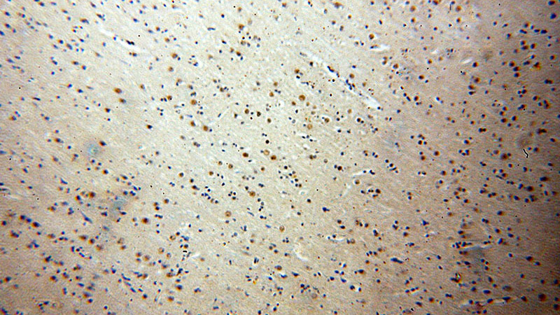 Immunohistochemical of paraffin-embedded human brain using Catalog No:113607(PAX6 antibody) at dilution of 1:50 (under 10x lens)