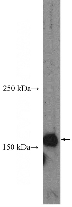 HL-60 cells were subjected to SDS PAGE followed by western blot with Catalog No:109041(CD11B/Integrin alpha M Antibody) at dilution of 1:600