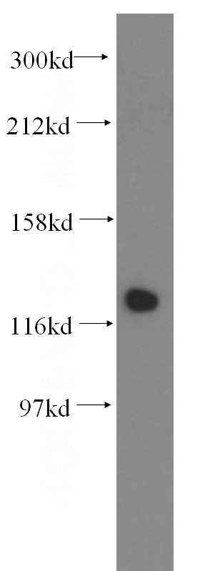 mouse testis tissue were subjected to SDS PAGE followed by western blot with Catalog No:109770(DDB1 antibody) at dilution of 1:500
