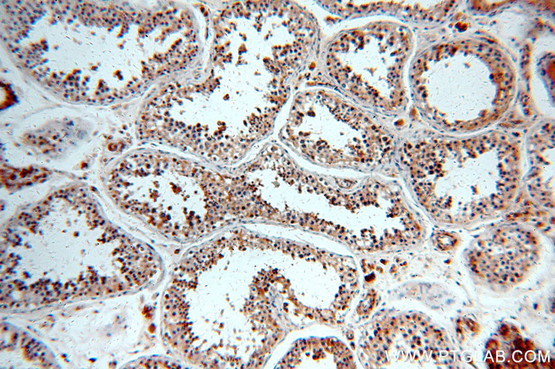 Immunohistochemical of paraffin-embedded human testis using Catalog No:115304(SLC16A12 antibody) at dilution of 1:50 (under 10x lens)