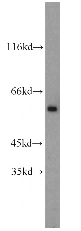 Jurkat cells were subjected to SDS PAGE followed by western blot with Catalog No:115665(SRC antibody) at dilution of 1:1000