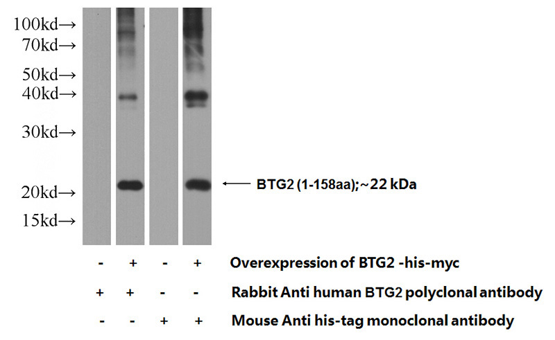 Transfected HEK-293 cells were subjected to SDS PAGE followed by western blot with Catalog No:108542(BTG2 Antibody) at dilution of 1:1000