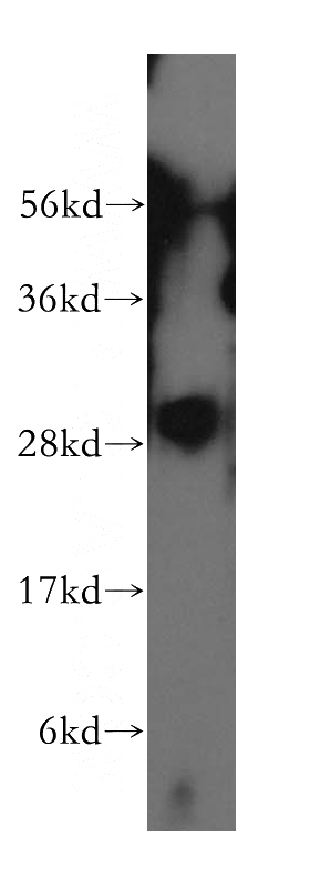human skin tissue were subjected to SDS PAGE followed by western blot with Catalog No:117271(ZWINT antibody) at dilution of 1:300