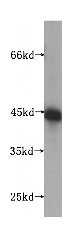 human liver tissue were subjected to SDS PAGE followed by western blot with Catalog No:116668(UBXN1 antibody) at dilution of 1:500