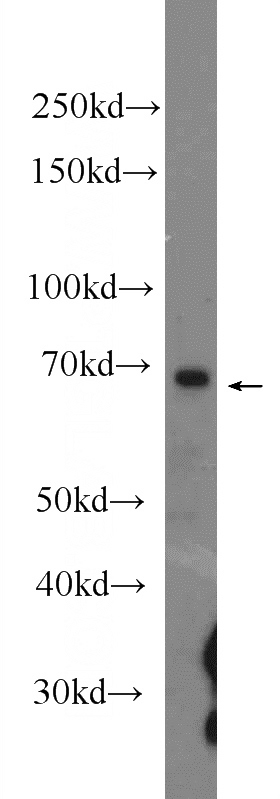 U-937 cells were subjected to SDS PAGE followed by western blot with Catalog No:109309(BIRC3 Antibody) at dilution of 1:1000