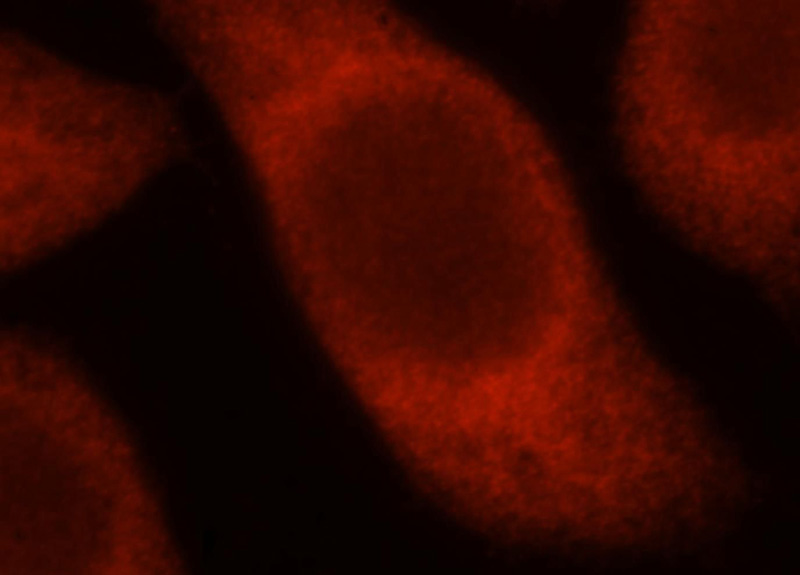 Immunofluorescent analysis of MCF-7 cells, using TSR2 antibody Catalog No:116371 at 1:25 dilution and Rhodamine-labeled goat anti-rabbit IgG (red).