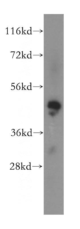 HEK-293 cells were subjected to SDS PAGE followed by western blot with Catalog No:112458(MAK16 antibody) at dilution of 1:500