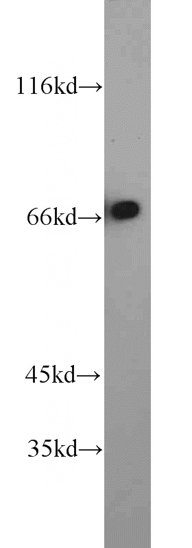 Jurkat cells were subjected to SDS PAGE followed by western blot with Catalog No:114951(RYK antibody) at dilution of 1:1000