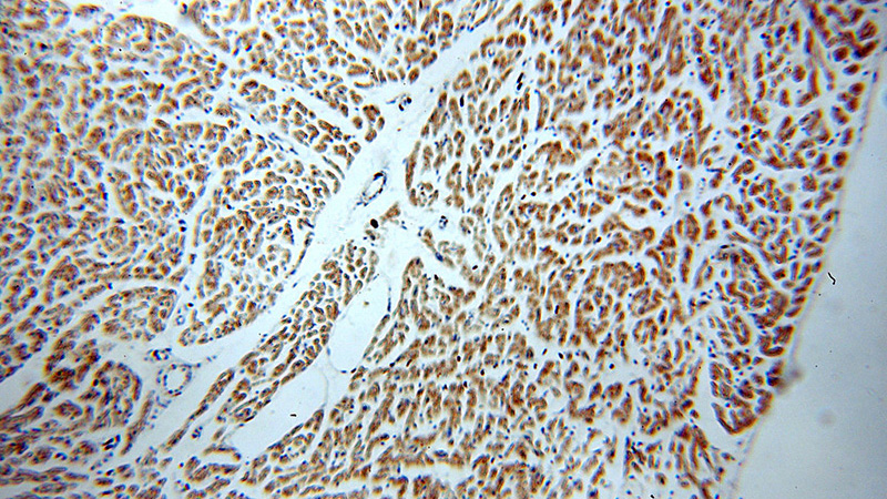 Immunohistochemical of paraffin-embedded human heart using Catalog No:110572(FAM156A antibody) at dilution of 1:50 (under 10x lens)