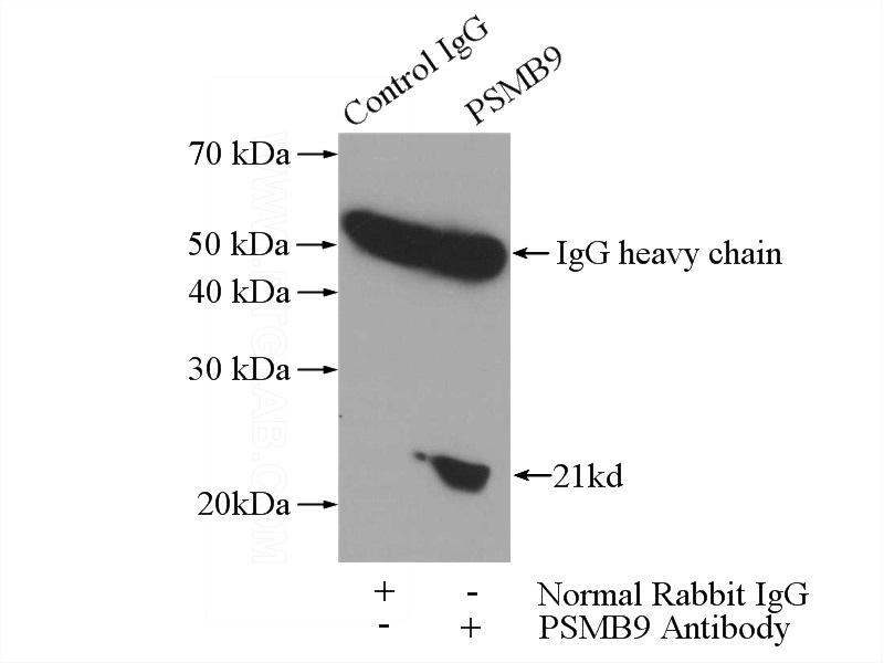 IP Result of anti-PSMB9 (IP:Catalog No:112286, 4ug; Detection:Catalog No:112286 1:300) with Raji cells lysate 2800ug.