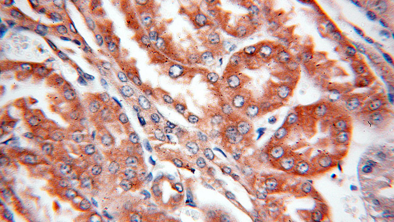 Immunohistochemical of paraffin-embedded human kidney using Catalog No:110525(FARSA antibody) at dilution of 1:100 (under 40x lens)
