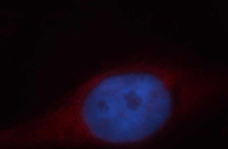 Immunofluorescent analysis of Hela cells, using GUCY1B3 antibody Catalog No:111249 at 1:25 dilution and Rhodamine-labeled goat anti-rabbit IgG (red). Blue pseudocolor = DAPI (fluorescent DNA dye).