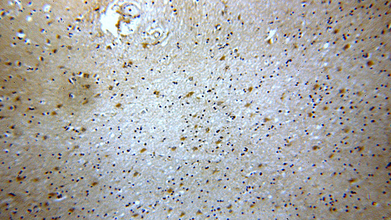 Immunohistochemical of paraffin-embedded human brain using Catalog No:115944(TNR-Specific antibody) at dilution of 1:100 (under 10x lens)