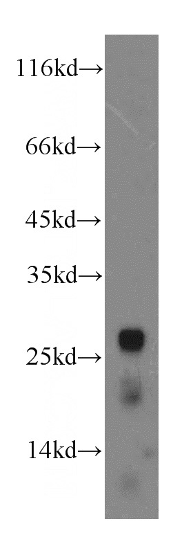 mouse pancreas tissue were subjected to SDS PAGE followed by western blot with Catalog No:109306(CTRL antibody) at dilution of 1:3000