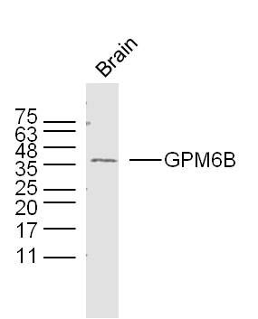Fig3: Sample: Brain (Mouse) Lysate at 40 ug; Primary: Anti-GPM6B at 1/300 dilution; Secondary: IRDye800CW Goat Anti-Rabbit IgG at 1/20000 dilution; Predicted band size: 29 kD; Observed band size: 36 kD