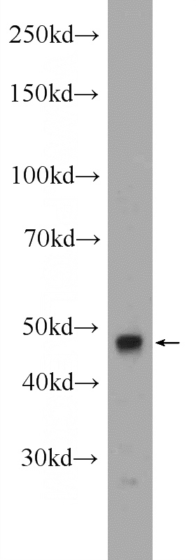 mouse testis tissue were subjected to SDS PAGE followed by western blot with Catalog No:109399(CLP1 Antibody) at dilution of 1:600