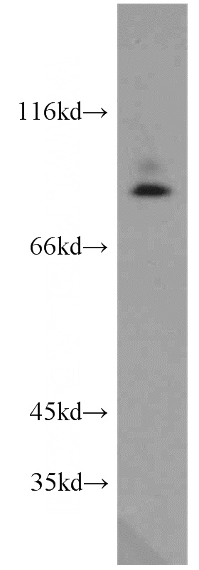 mouse brain tissue were subjected to SDS PAGE followed by western blot with Catalog No:114203(PRKG2 antibody) at dilution of 1:500