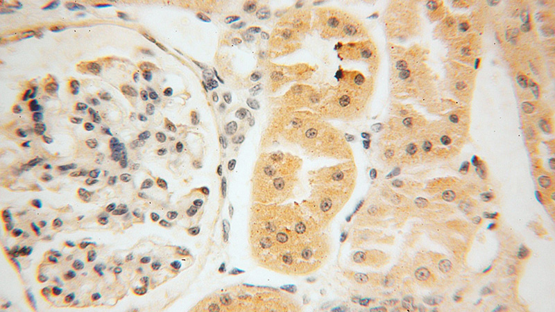 Immunohistochemical of paraffin-embedded human kidney using Catalog No:112859(MRPS36 antibody) at dilution of 1:50 (under 40x lens)