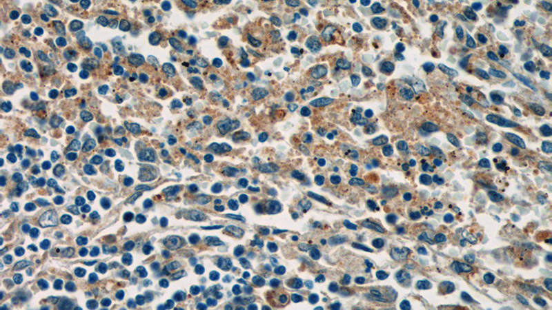 Immunohistochemistry of paraffin-embedded human spleen tissue slide using Catalog No:107488(SELP Antibody) at dilution of 1:50 (under 40x lens)