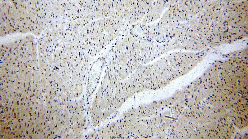 Immunohistochemical of paraffin-embedded human heart using Catalog No:114045(POLR2J antibody) at dilution of 1:100 (under 10x lens)