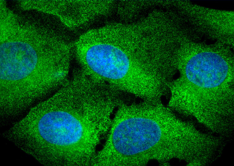 IF result of Catalog No:113705(PELO antibody) in U2OS cell by Dr. Nancy Kedersha.(cytoplasm and nucleus; Green).