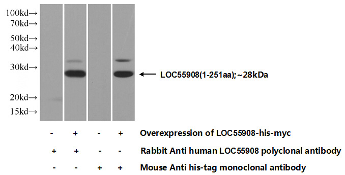 Transfected HEK-293 cells were subjected to SDS PAGE followed by western blot with Catalog No:112293(Loc55908 Antibody) at dilution of 1:1000