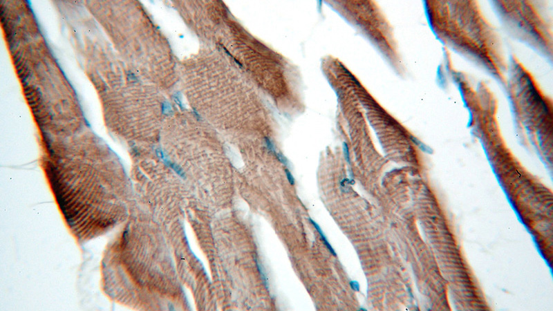 Immunohistochemical of paraffin-embedded human skeletal muscle using Catalog No:109542(CKM-Specific antibody) at dilution of 1:100 (under 40x lens)