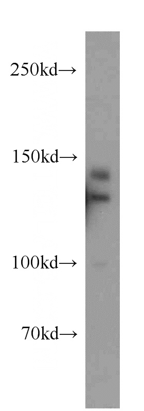 MCF7 cells were subjected to SDS PAGE followed by western blot with Catalog No:116358(TRERF1 antibody) at dilution of 1:300