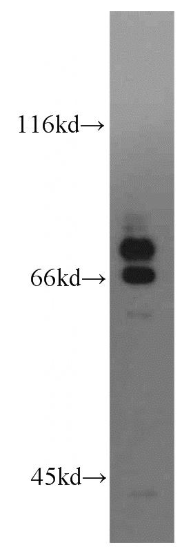 A431 cells were subjected to SDS PAGE followed by western blot with Catalog No:114990(SCEL antibody) at dilution of 1:300