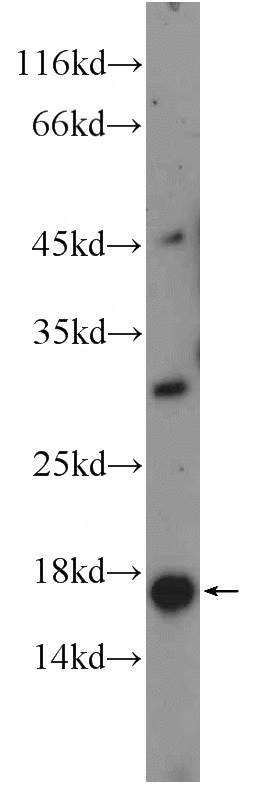 mouse testis tissue were subjected to SDS PAGE followed by western blot with Catalog No:108806(C9orf9 Antibody) at dilution of 1:300