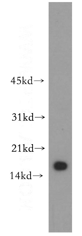 human stomach tissue were subjected to SDS PAGE followed by western blot with Catalog No:116512(UBD antibody) at dilution of 1:300