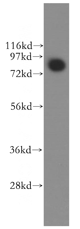 Jurkat cells were subjected to SDS PAGE followed by western blot with Catalog No:112555(MCM5 antibody) at dilution of 1:500