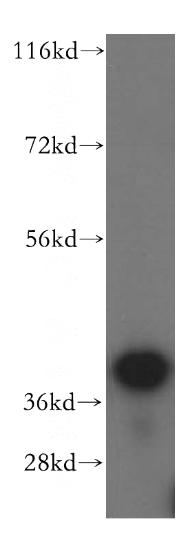 human liver tissue were subjected to SDS PAGE followed by western blot with Catalog No:108558(BXDC2 antibody) at dilution of 1:500