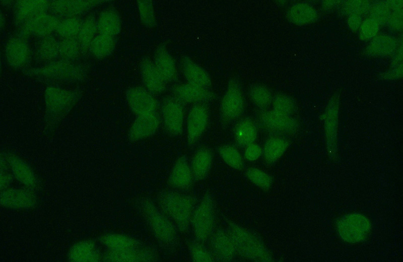 Immunofluorescent analysis of HeLa cells using Catalog No:114794(RPA2 Antibody) at dilution of 1:50 and Alexa Fluor 488-congugated AffiniPure Goat Anti-Rabbit IgG(H+L)