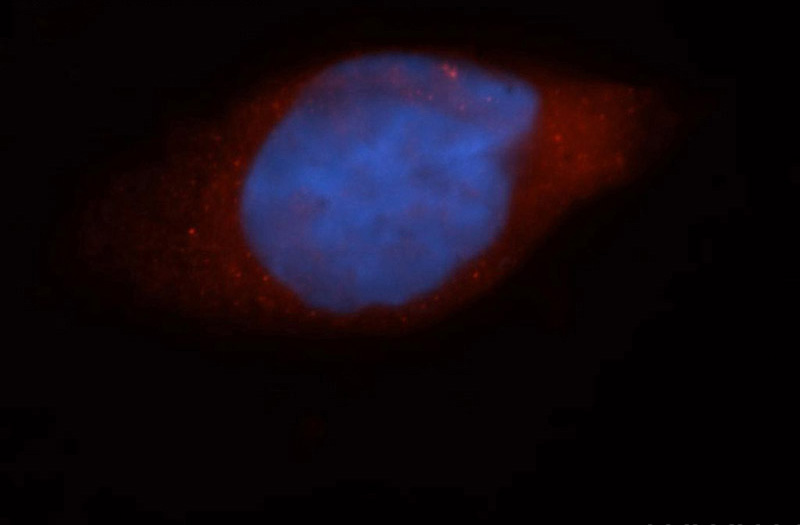 Immunofluorescent analysis of Hela cells, using AGAP2 antibody Catalog No:107914 at 1:50 dilution and Rhodamine-labeled goat anti-rabbit IgG (red). Blue pseudocolor = DAPI (fluorescent DNA dye).