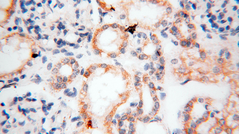 Immunohistochemical of paraffin-embedded human kidney using Catalog No:110165(MAPRE1 antibody) at dilution of 1:100 (under 40x lens)