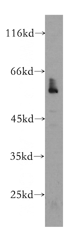 MCF7 cells were subjected to SDS PAGE followed by western blot with Catalog No:107336(NR1H3 antibody) at dilution of 1:300