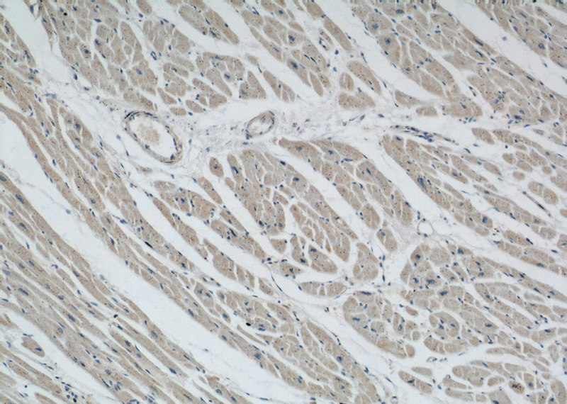 Immunohistochemical of paraffin-embedded human heart using Catalog No:115683(ABRA antibody) at dilution of 1:50 (under 10x lens)