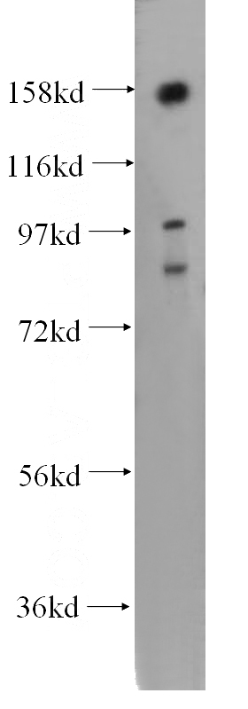 SGC-7901 cells were subjected to SDS PAGE followed by western blot with Catalog No:113297(NOL8 antibody) at dilution of 1:500