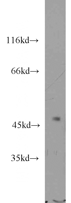 mouse brain tissue were subjected to SDS PAGE followed by western blot with Catalog No:113958(PLEKHA8 antibody) at dilution of 1:800
