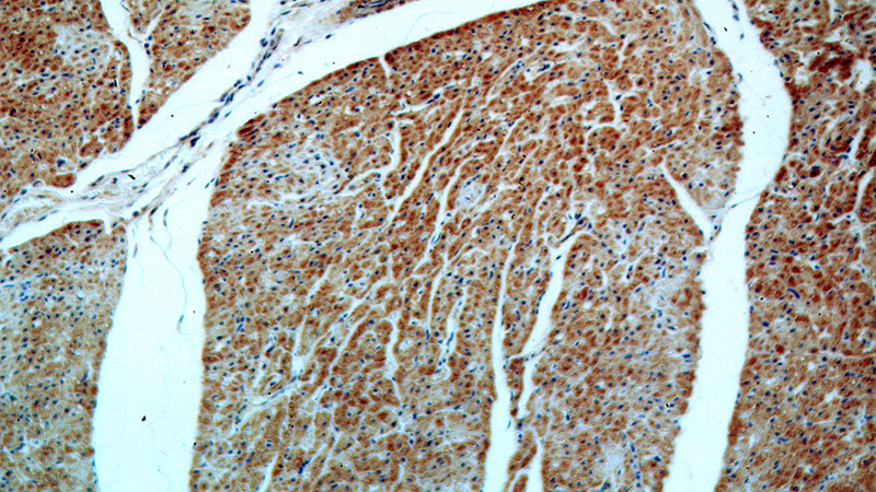 Immunohistochemical of paraffin-embedded human heart using Catalog No:115634(ST8SIA2-Specific antibody) at dilution of 1:50 (under 10x lens)