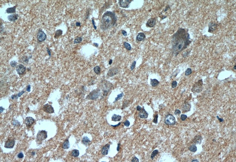 Immunohistochemistry of paraffin-embedded human brain tissue slide using Catalog No:109858(DAOA Antibody) at dilution of 1:50 (under 40x lens)
