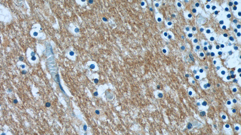 Immunohistochemistry of paraffin-embedded human cerebellum tissue slide using Catalog No:108082(ANKRD57 Antibody) at dilution of 1:50 (under 40x lens)