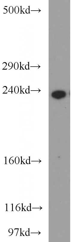 A375 cells were subjected to SDS PAGE followed by western blot with Catalog No:109605(CSPG4,NG2 antibody) at dilution of 1:300